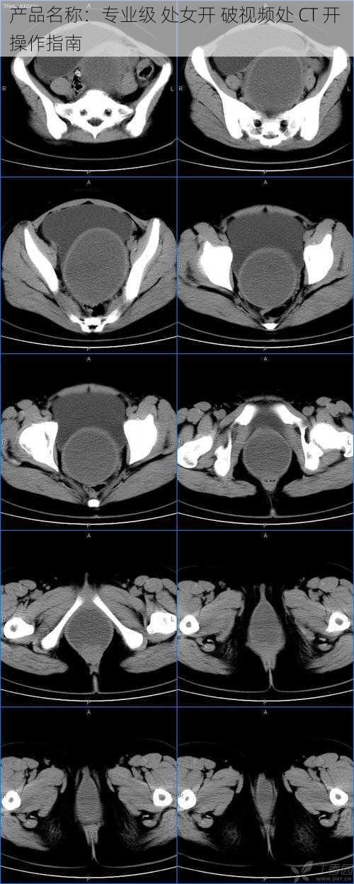 产品名称：专业级 处女开 破视频处 CT 开 操作指南